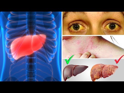 Bakterielle Prostatitis, was zu übergeben Analysen Die neueste Generation von Fluorchinolone in Prostatitis