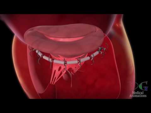 DG Medical Animations: 30 second demo compilation