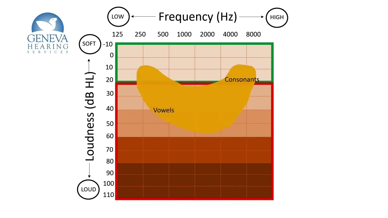 Reading an Audiogram: Decoding the Frequency Graph