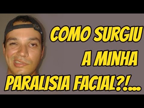 Como Surgiu a Minha Paralisia Facial?
