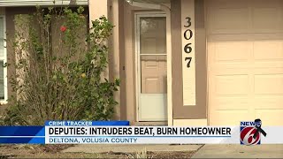 Victim beaten, burned during home invasion
