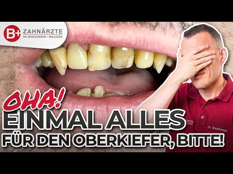 Zahnersatz OHNE Implantate oder Zahnprothese! Oberkiefer Komplett-Versorgung mit Zahnkronen!