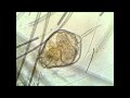 Rotifer Video Taken At 1024 X 768 With Tucsen Microscope Camera Using MICAM