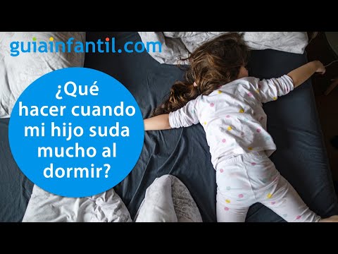 Why does my child sweat so much during naps or at night? | Excessive sweating in babies and children