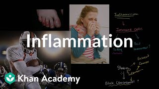 Inflammation