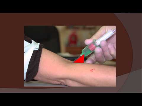 What is the proper angle-of-insertion for venipunctures?