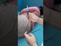 Im Injection Vlog Video