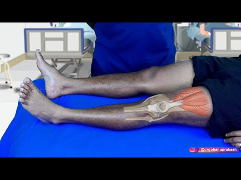 Knee Joint Examination - OSCE Orthopedics : Clinical essentials
