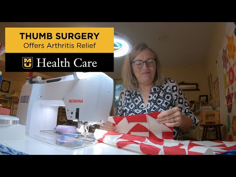 Thumb Surgery Offers Arthritis Relief, Quick Recovery (Daniel London, MD)