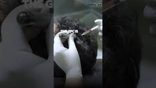 Download lagu Growth Factor Concentrate (GFC) for Hair Fall | How It Helps Thinning Hair mp3