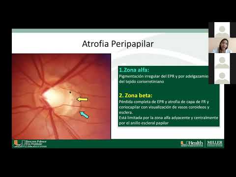 Glaucoma College