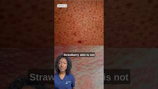 Hidden Causes Of Strawberry Skin + Products | Causes Of Red Dots On Legs