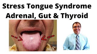 Stress Tongue Syndrome Adrenal, Gut & Thyroid