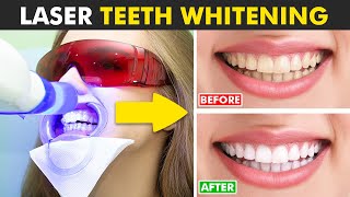 Laser Teeth Whitening Procedure