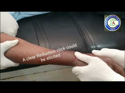 Fracture Lower end Radius | LE Radius fracture closed reduction | Fiberglass plastering | Adamya H V