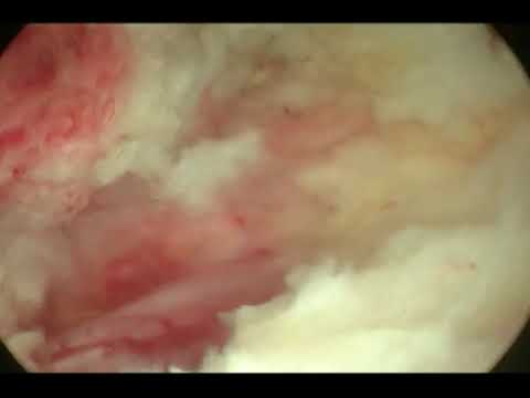Andrea Cattalani-10