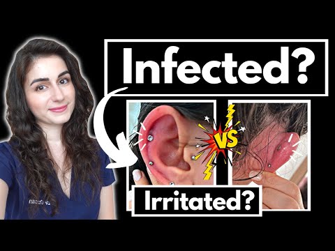 Doctor explains: Is your piercing infected? How to care for a new cartilage piercing