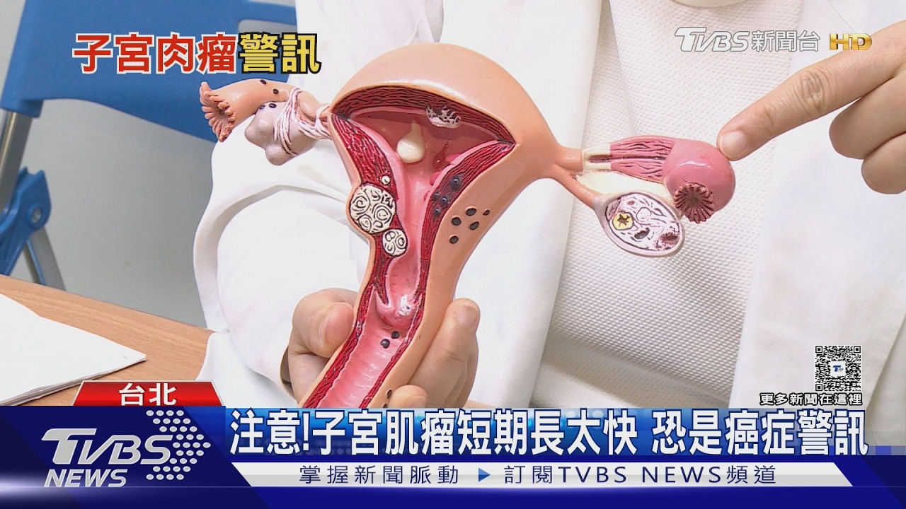 子宮肌瘤長太快 恐不是良性!醫揭子宮肉癌「五大警訊」
