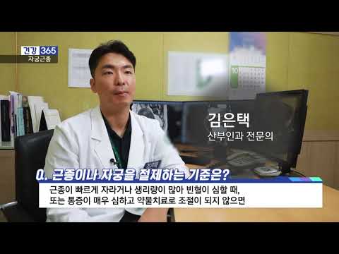 (KNN 건강365)산부인과 김은택 교수 - 자궁근종