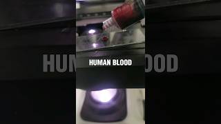 Download lagu human blood under the microscope #laboratory #medtechstudent #mls #cls #bloodcells #microscope #bld mp3