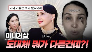 미니거상 진짜 효과 없을까?그래서 미니거상이 뭔데? | 리프팅 REVIEW❣