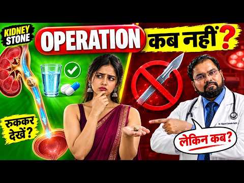 Kidney Stone Surgery Needed? | हर पथरी में Surgery जरूरी नहीं
