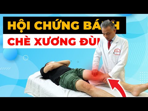 Đau Đầu Gối Dai Dẳng? Có Thể Bạn Đang Mắc Hội Chứng Bánh Chè Xương Đùi