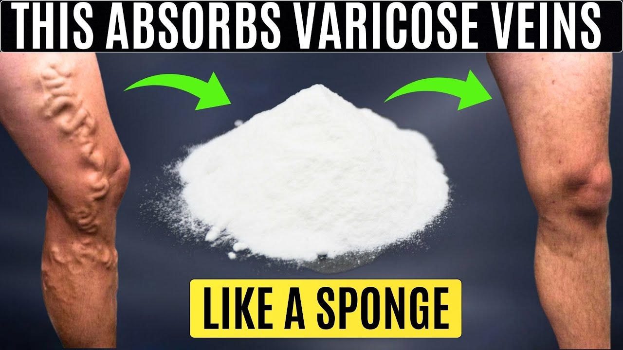 Old Surgeon: By Day Seven, Varicose Veins Vanished—Take 5-7 Tablets in a Glass of Water and…