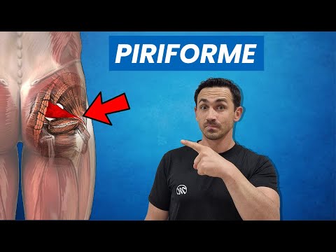 Traitement du Piriforme : 5 étirements différents