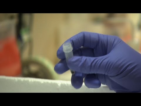 A London man appears to be free of the AIDS virus after a stem cell transplant, the second success from this procedure to treat the disease. (March 5)