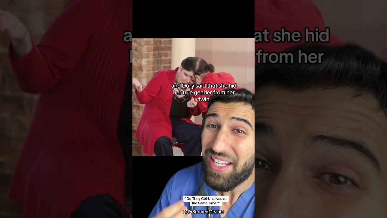 “Do They Get Unalived at the Same Time” #conjoinedtwins