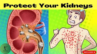 12 Signs Your Kidneys Are Crying For Help#kidneydiseaseawareness