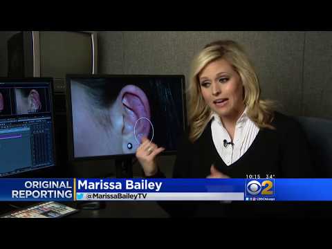 Fibromyalgia Treatment - New Ear Therapy to Relieve Pain (UPDATED Jan 2019)