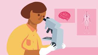 Vascular dementia