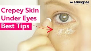 Crepey Skin Under The Eyes: Top Tips To Help