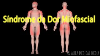 Síndrome de Dor Miofascial e Tratamentos de Pontos Gatilho, Animação. Alila Medical Media Português.