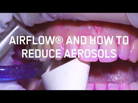 Airflow® and how to reduce aerosols