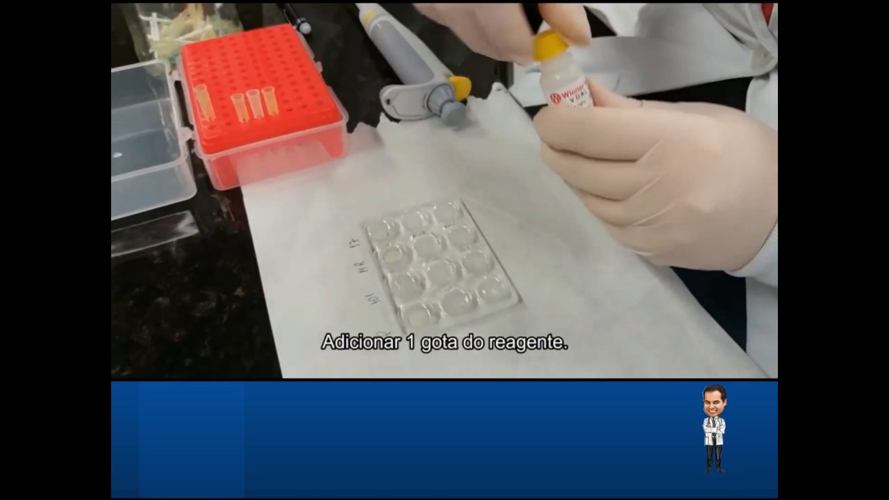 VDRL O que todo Biomédico Residente precisa saber!!!!