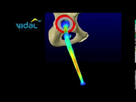 Movimento de Circundução do Quadril - Vidal