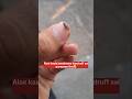 Treat Oily Dandruff In Just 30sec Dandruff