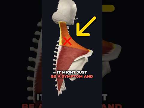 Tight Upper Traps causing Shoulder Pain?