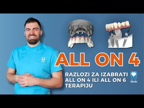 ALL ON 4 - Razlozi za izabrati ALL ON 4 ili ALL ON 6 terapiju