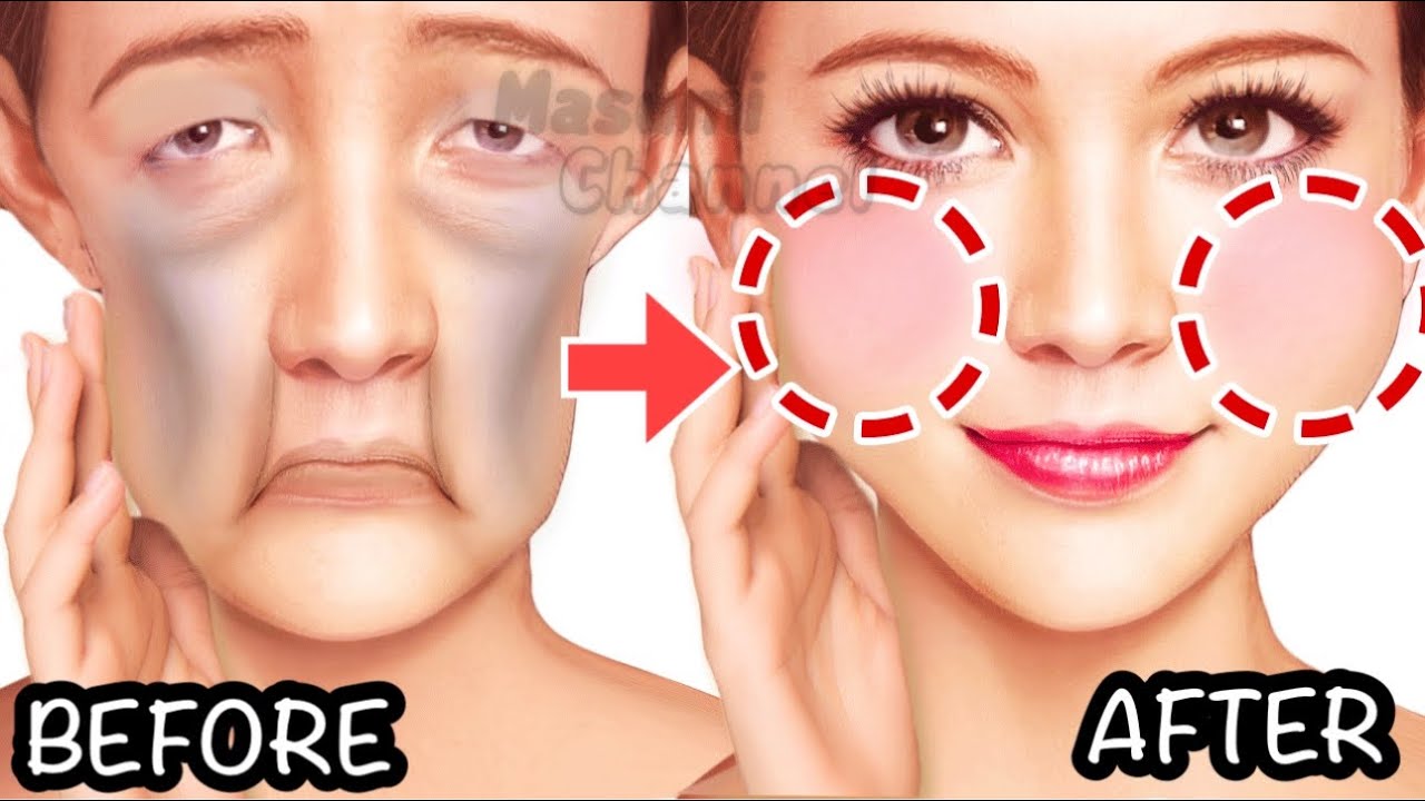 Quick Result! Get Chubby Cheeks, Fuller Cheeks Naturally With This Exercise & Massage At Home✨