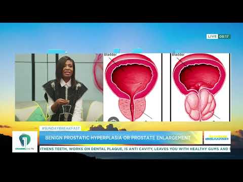 Prostate Enlargement (BPH): What Every Man Should Know – Dr. Oum-Kalsoum Zakaria Adam Explains