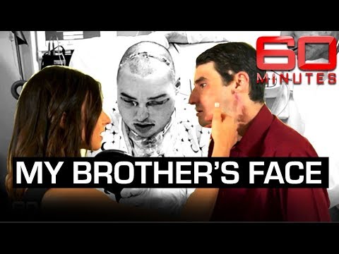 World first face transplant: meeting the man who wears 'my brother's face' | 60 Minutes Australia