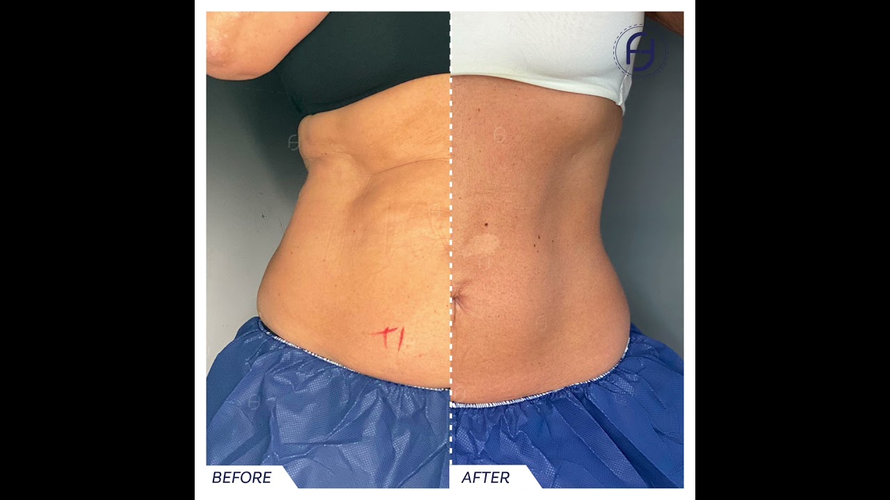 Francesca Flagiello-98