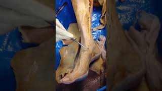 Femoral Nerve and Dorsum of the Foot dissection of cadaver- human anatomy lab- 1st MBBS