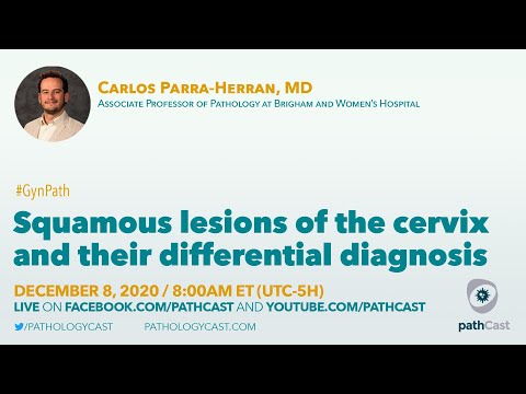 Squamous lesions of the cervix and their differential diagnosis Dr. Parra-Harran (BWH) #GYNPATH