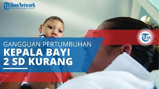 Mikrosefali, Keadaan ketika Ukuran Kepala Kurang dari 2 SD di Bawah Rata-rata Usia dan Jenis Kelamin