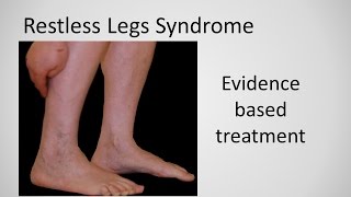 Restless Leg Syndrome evidence based treatment